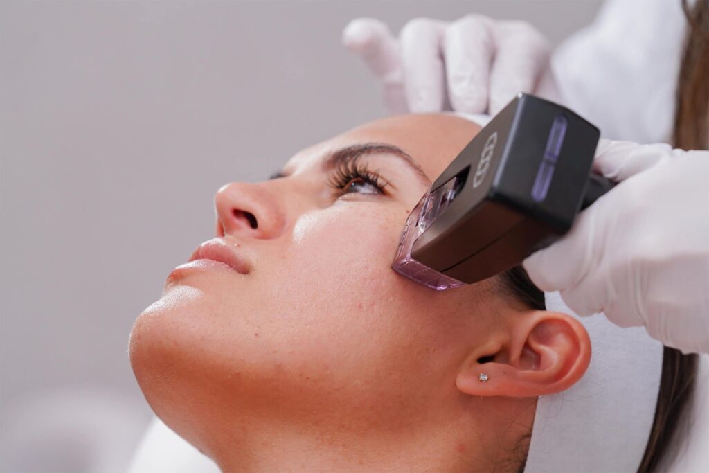 BDR clinic-Morpheus8 malta micronedling