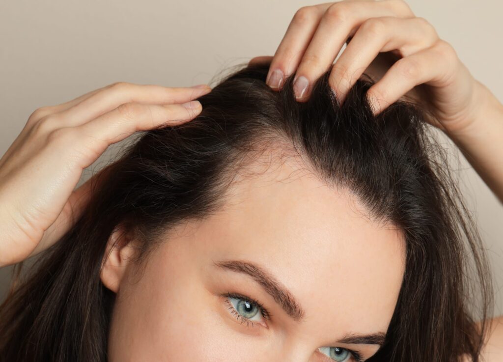 Exosomes For Hair Loss women