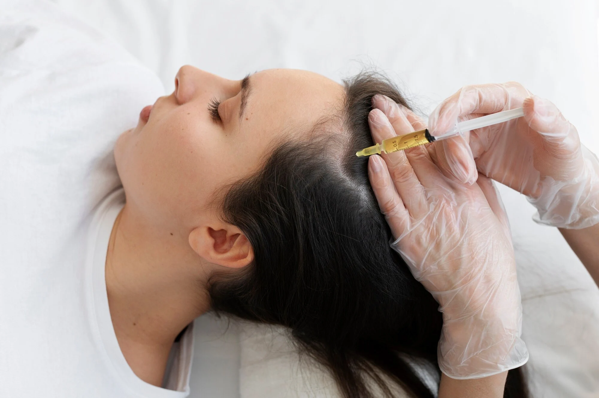 hair_treatment regeneration injections losing hair woman
