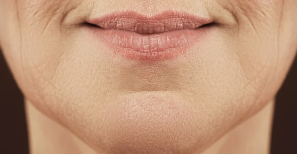 Woman noticing early jawline aging and loss of facial definition