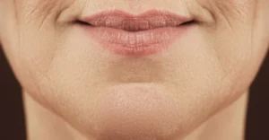 Woman noticing early jawline aging and loss of facial definition