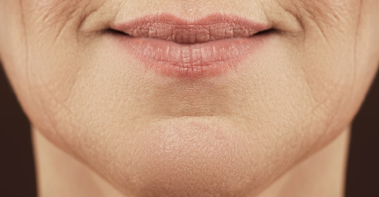 Woman noticing early jawline aging and loss of facial definition