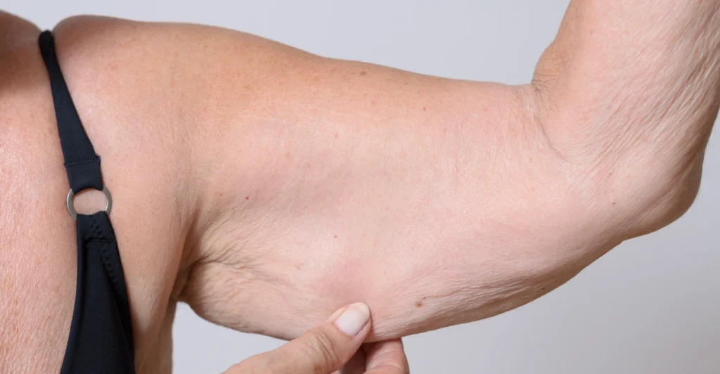 loss of skin firmness
