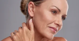 collagen loss in women