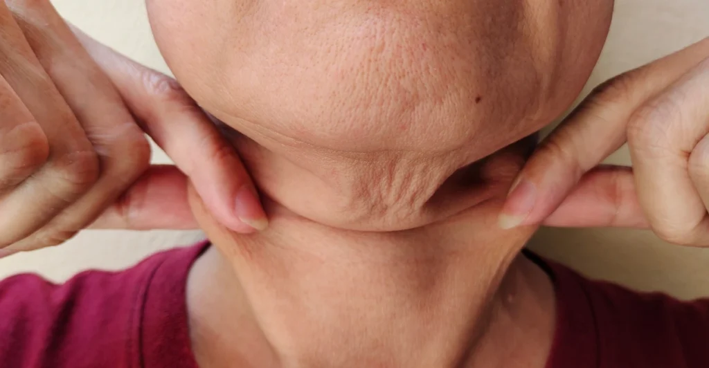 facial aging women