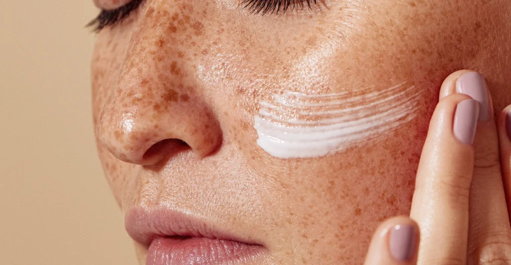 Professional skin assessment for UV damage and pigmentation at BDR Clinic Malta