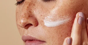 Professional skin assessment for UV damage and pigmentation at BDR Clinic Malta