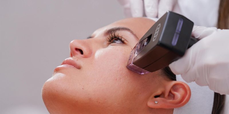 BDR clinic-Morpheus8 malta micronedling