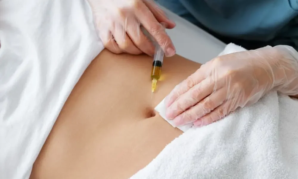 Body Mesotherapy BDR clinic Malta