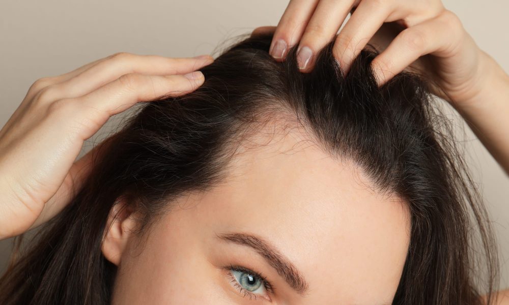 Exosomes For Hair Loss women