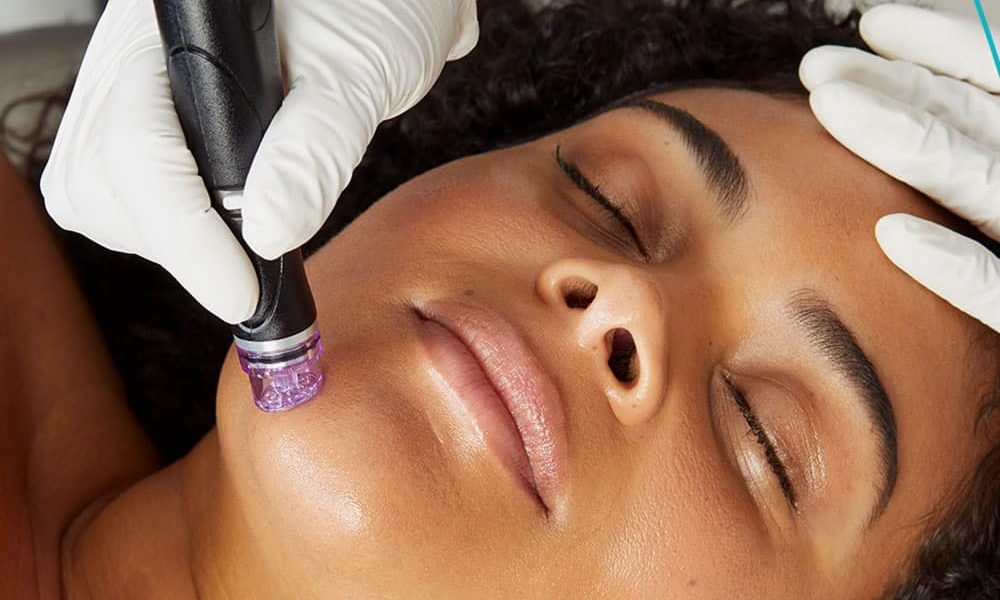 Hydrafacial treatment in Malta BDR Clinic