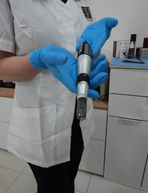 PEELING SKIN CARE (NOON CLINIC MALTA) microneedling